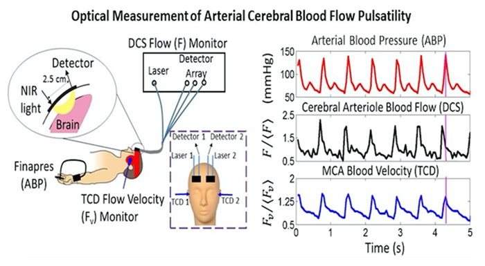 CMROI graphic: Measurement of arterial blood flow pulsatility with optics.